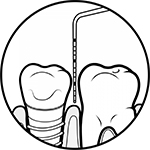 口腔内の診査